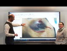 $15.9 Million Verdict in Personal Injury Product Liability Case