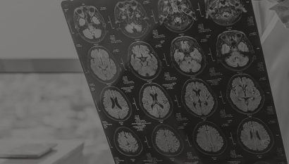 Pa Brain Injuries X-ray