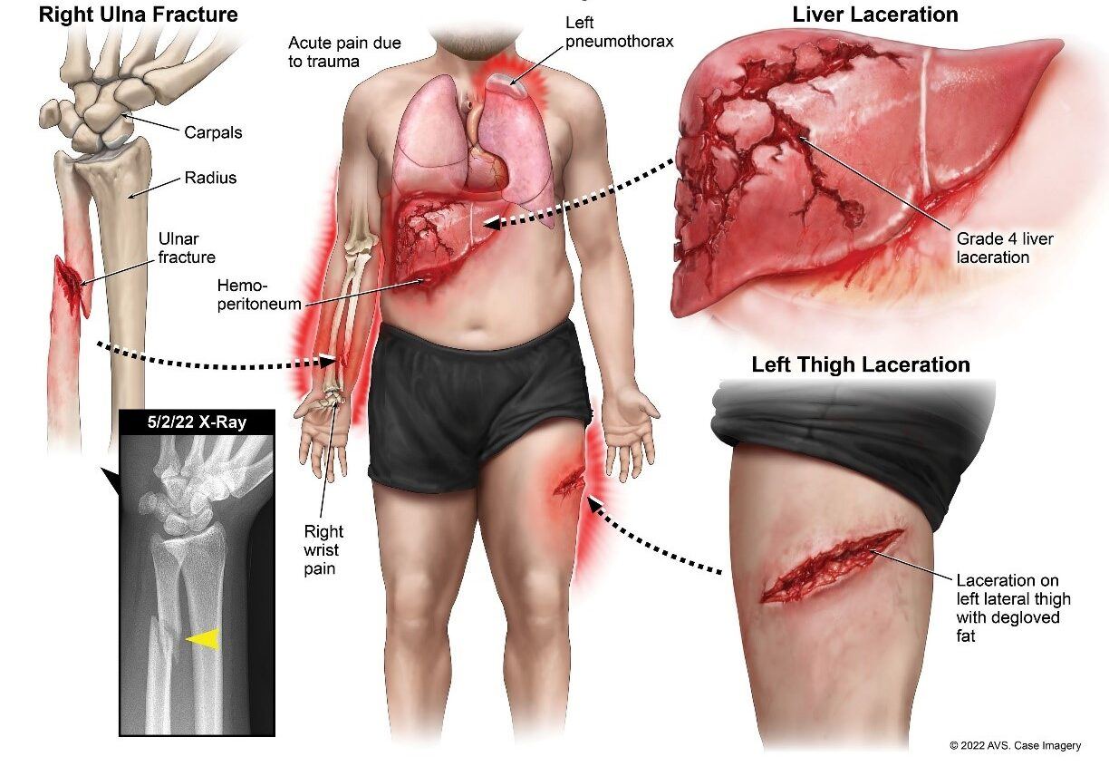 Mr. Ramos’ injuries